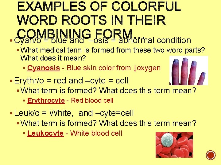 § Cyan/o = blue and –osis = abnormal condition § What medical term is