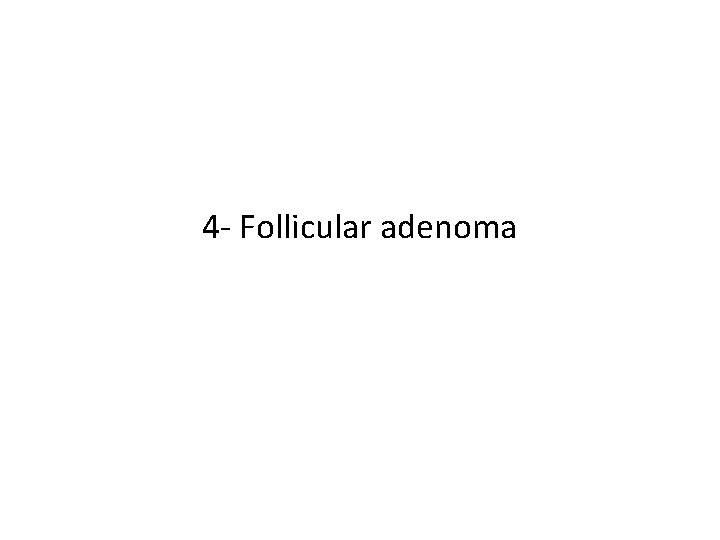 4 - Follicular adenoma 4 - Follicular adenoma