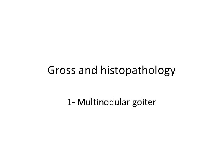 Gross and histopathology 1 - Multinodular goiter Gross and histopathology 1 - Multinodular goiter