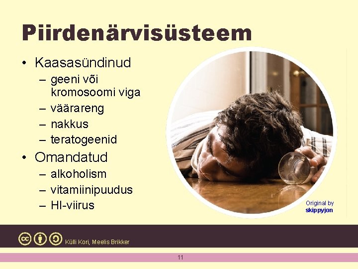 Piirdenärvisüsteem • Kaasasündinud – geeni või kromosoomi viga – väärareng – nakkus – teratogeenid