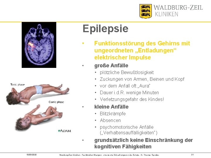 Epilepsie • Funktionsstörung des Gehirns mit ungeordneten „Entladungen“ elektrischer Impulse • große Anfälle •