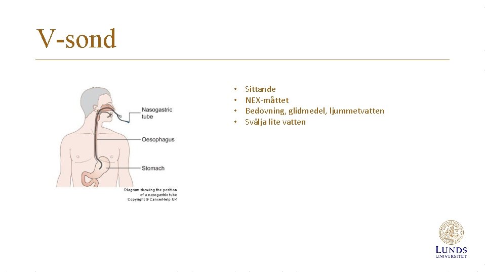 V-sond • • Sittande NEX-måttet Bedövning, glidmedel, ljummetvatten Svälja lite vatten 
