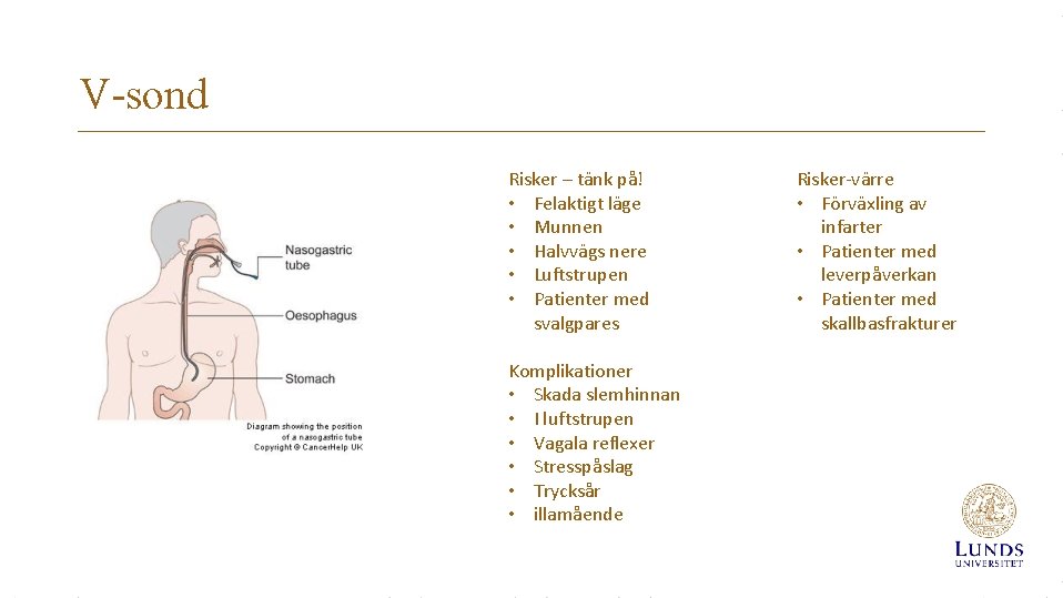 V-sond Risker – tänk på! • Felaktigt läge • Munnen • Halvvägs nere •
