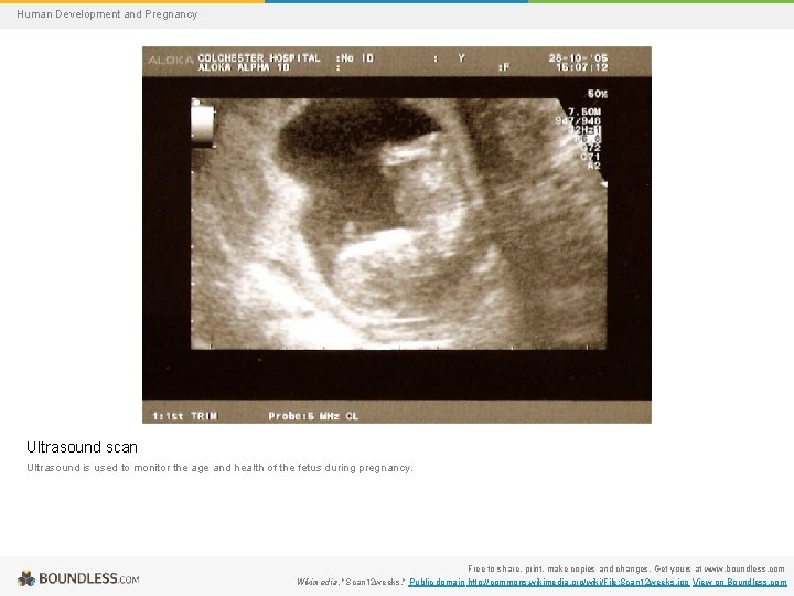 Human Development and Pregnancy Ultrasound scan Ultrasound is used to monitor the age and