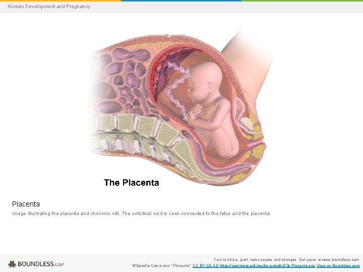 Human Development and Pregnancy Placenta Image illustrating the placenta and chorionic villi. The umbilical