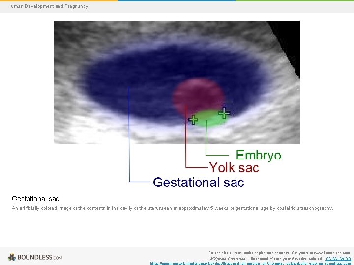 Human Development and Pregnancy Gestational sac An artificially colored image of the contents in