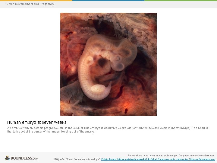 Human Development and Pregnancy Human embryo at seven weeks An embryo from an ectopic