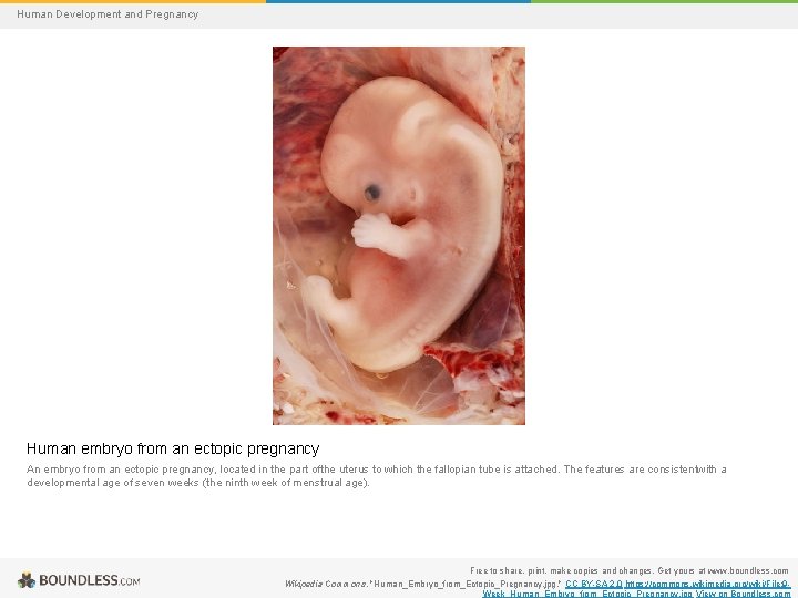 Human Development and Pregnancy Human embryo from an ectopic pregnancy An embryo from an