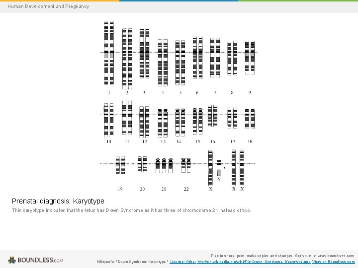 Human Development and Pregnancy Prenatal diagnosis: Karyotype This karyotype indicates that the fetus has