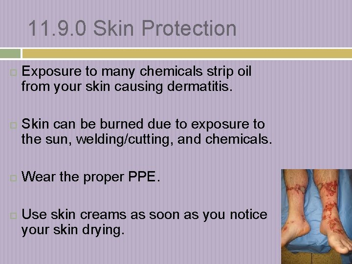 11. 9. 0 Skin Protection Exposure to many chemicals strip oil from your skin
