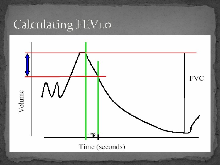 Calculating FEV 1. 0 