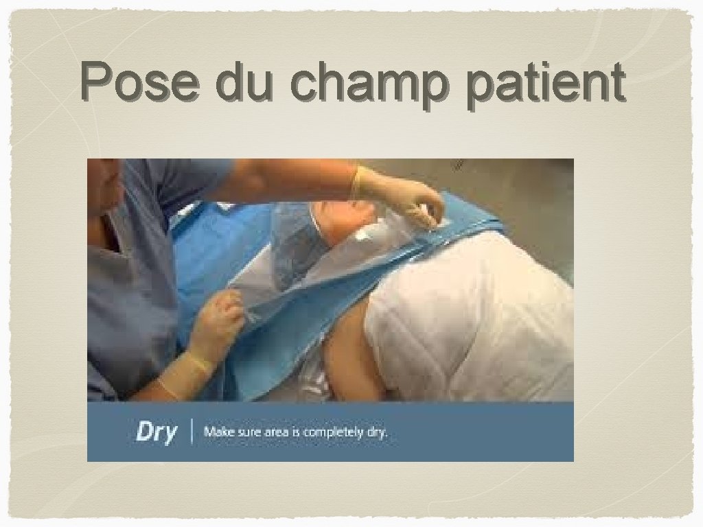 Pose du champ patient 