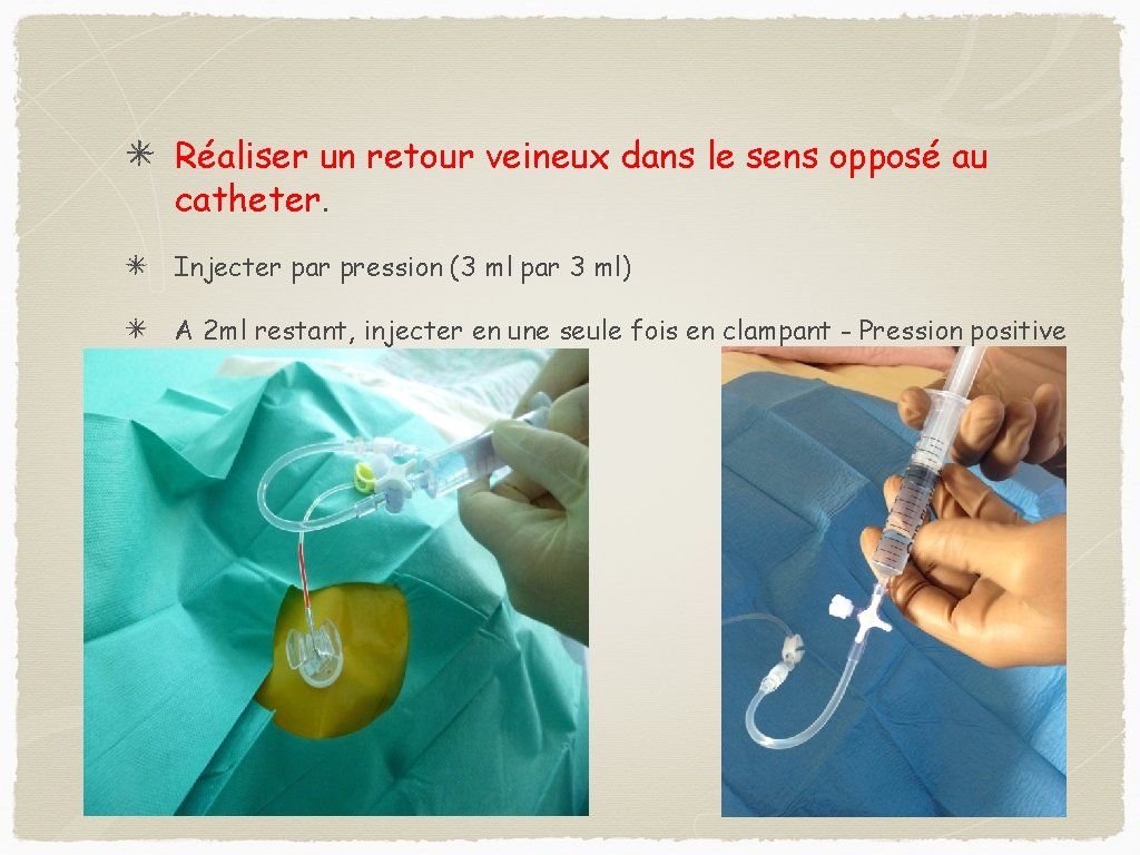 Réaliser un retour veineux dans le sens opposé au catheter. Injecter par pression (3