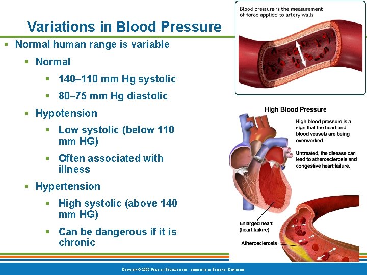 Variations in Blood Pressure § Normal human range is variable § Normal § 140–