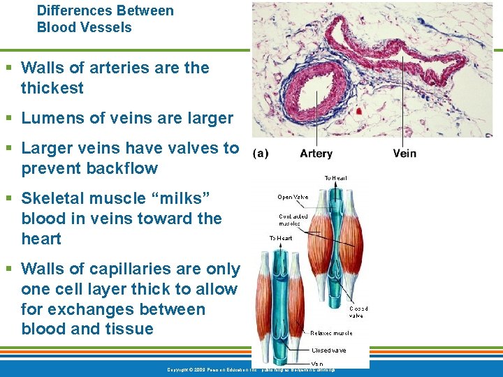 Differences Between Blood Vessels § Walls of arteries are thickest § Lumens of veins