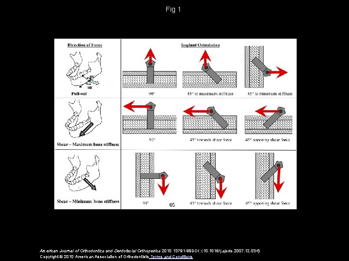 Fig 1 American Journal of Orthodontics and Dentofacial Orthopedics 2010 13791 -99 DOI: (10.