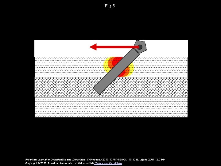 Fig 5 American Journal of Orthodontics and Dentofacial Orthopedics 2010 13791 -99 DOI: (10.