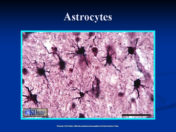 Astrocytes From http: //www. kumc. edu/instruction/medicine/anatomy/histoweb/nervous/nerve 15. htm 