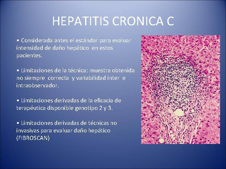 HEPATITIS CRONICA C • Considerada antes el estándar para evaluar intensidad de daño hepático