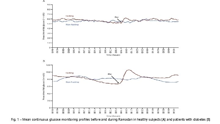 Fig. 1 – Mean continuous glucose monitoring proﬁles before and during Ramadan in healthy