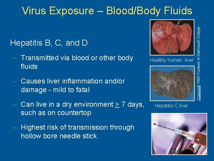 Hepatitis B, C, and D – Transmitted via blood or other body fluids Healthy