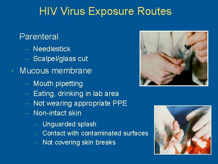 HIV Virus Exposure Routes Parenteral – Needlestick – Scalpel/glass cut • Mucous membrane –