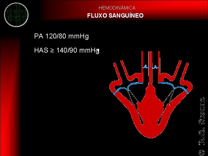 HEMODIN MICA FLUXO SANGUÍNEO PA 120/80 mm. Hg HAS ≥ 140/90 mm. Hg 