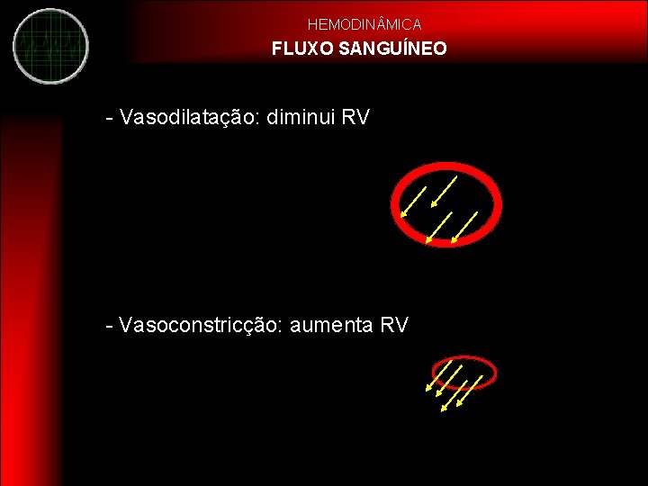 HEMODIN MICA FLUXO SANGUÍNEO - Vasodilatação: diminui RV - Vasoconstricção: aumenta RV 