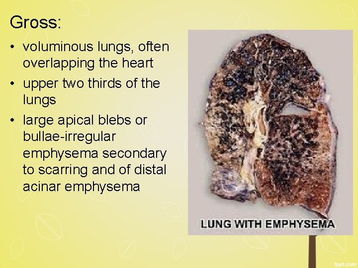 Gross: • voluminous lungs, often overlapping the heart • upper two thirds of the