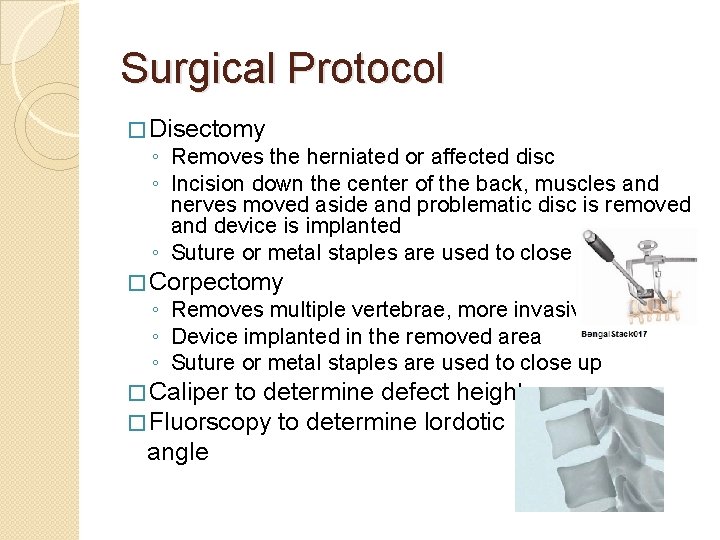 Surgical Protocol � Disectomy ◦ Removes the herniated or affected disc ◦ Incision down