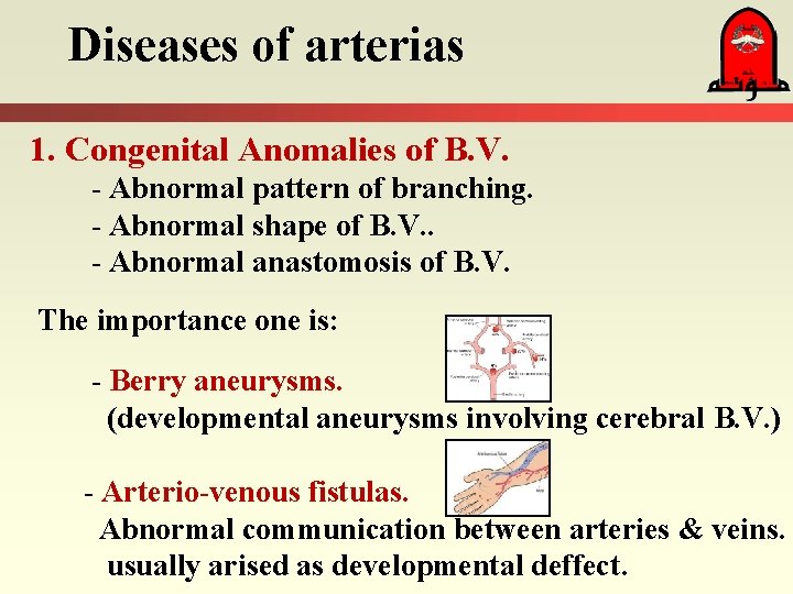 Diseases of arterias 1. Congenital Anomalies of B. V. - Abnormal pattern of branching.