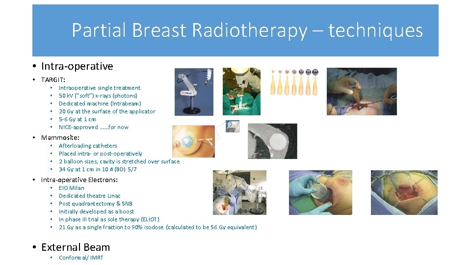 Partial Breast Radiotherapy – techniques • Intra-operative • TARGIT: • • • Intraoperative single