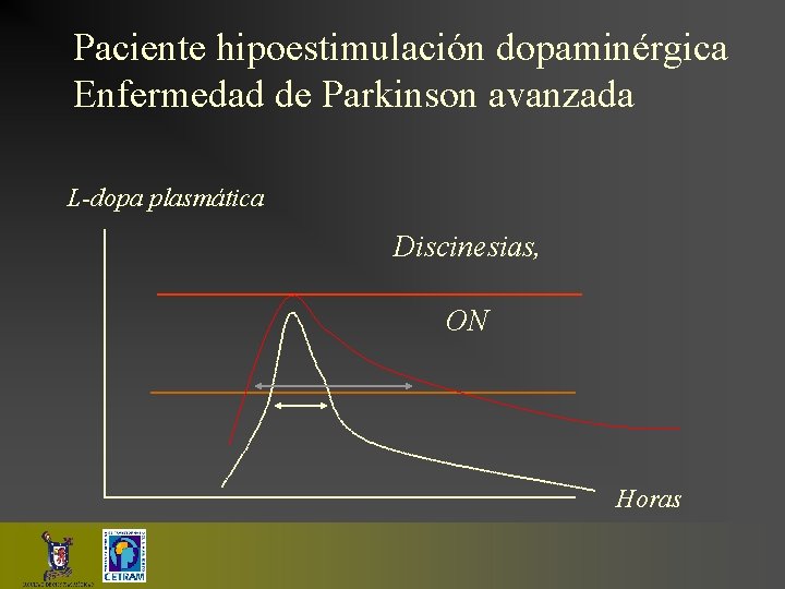 Paciente hipoestimulación dopaminérgica Enfermedad de Parkinson avanzada L-dopa plasmática Discinesias, ON Horas 