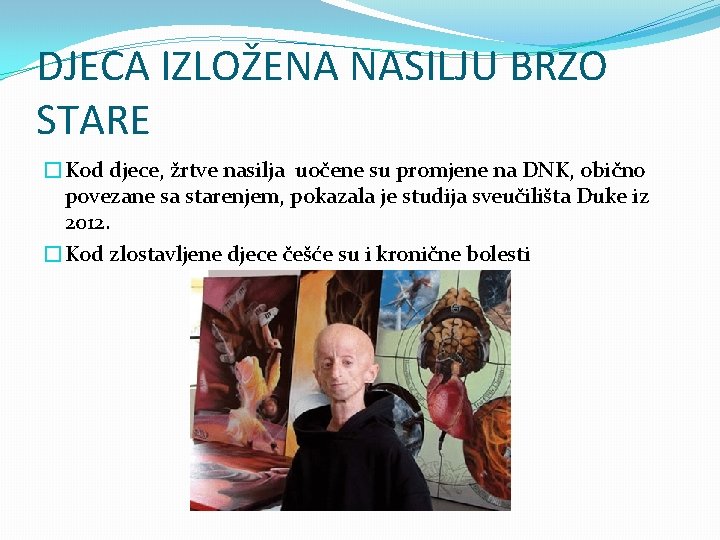 DJECA IZLOŽENA NASILJU BRZO STARE �Kod djece, žrtve nasilja uočene su promjene na DNK,