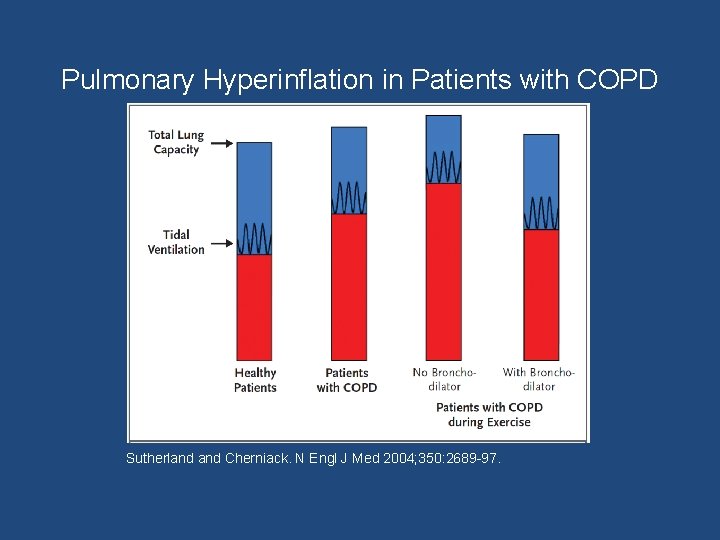 Pulmonary Hyperinflation in Patients with COPD Sutherland Cherniack. N Engl J Med 2004; 350: