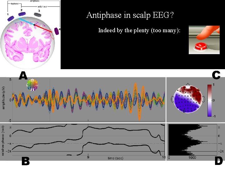 Antiphase in scalp EEG? Indeed by the plenty (too many): 28 