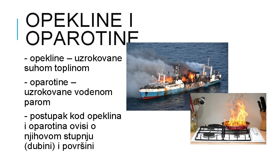 OPEKLINE I OPAROTINE - opekline – uzrokovane suhom toplinom - oparotine – uzrokovane vodenom