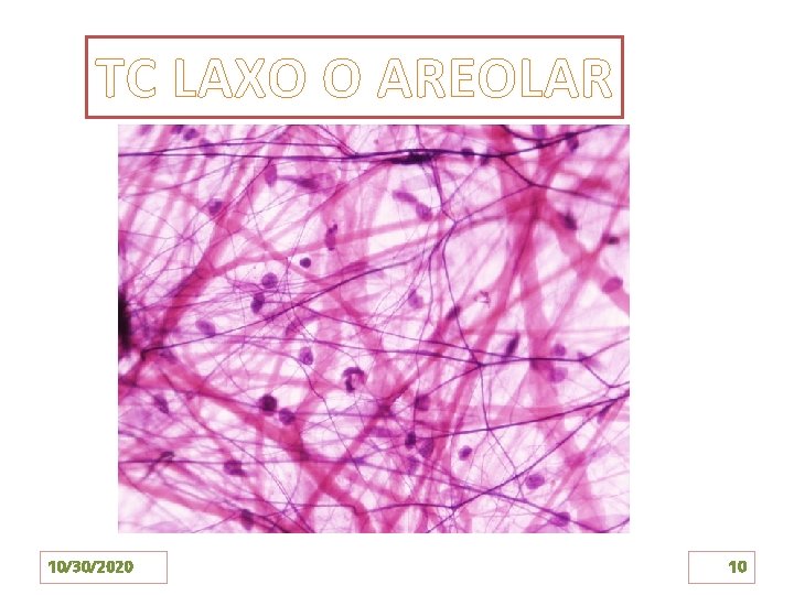 TC LAXO O AREOLAR 10/30/2020 10 