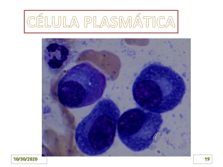 CÉLULA PLASMÁTICA 10/30/2020 19 