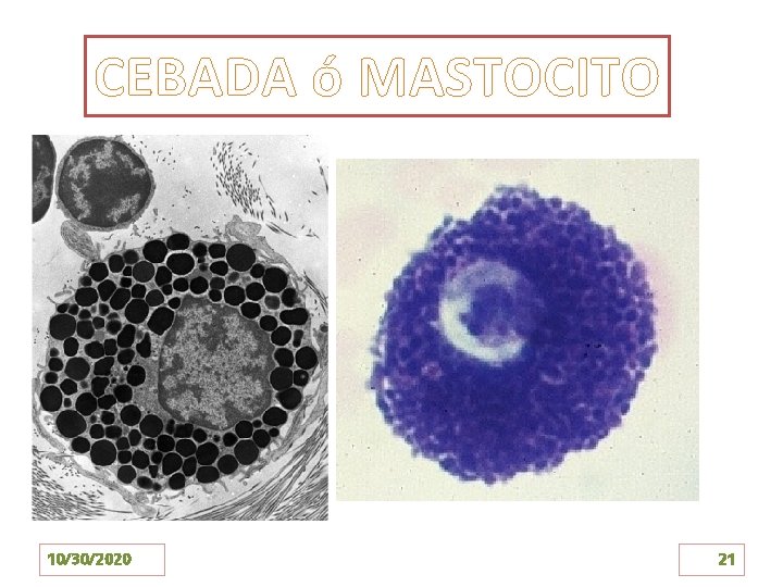 CEBADA ó MASTOCITO 10/30/2020 21 