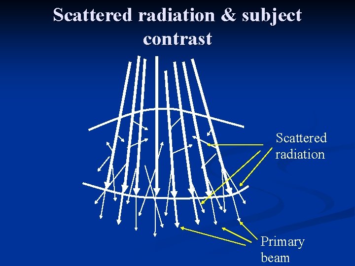 Scattered radiation & subject contrast Scattered radiation Primary beam 