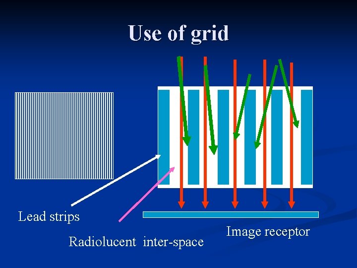 Use of grid Lead strips Radiolucent inter-space Image receptor 