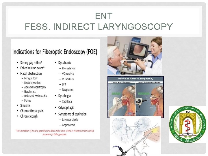 ENT FESS. INDIRECT LARYNGOSCOPY 