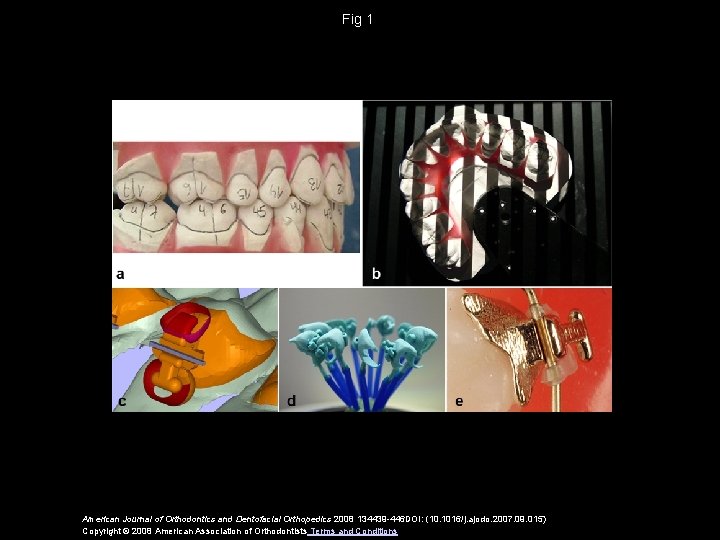 Fig 1 American Journal of Orthodontics and Dentofacial Orthopedics 2008 134439 -446 DOI: (10.