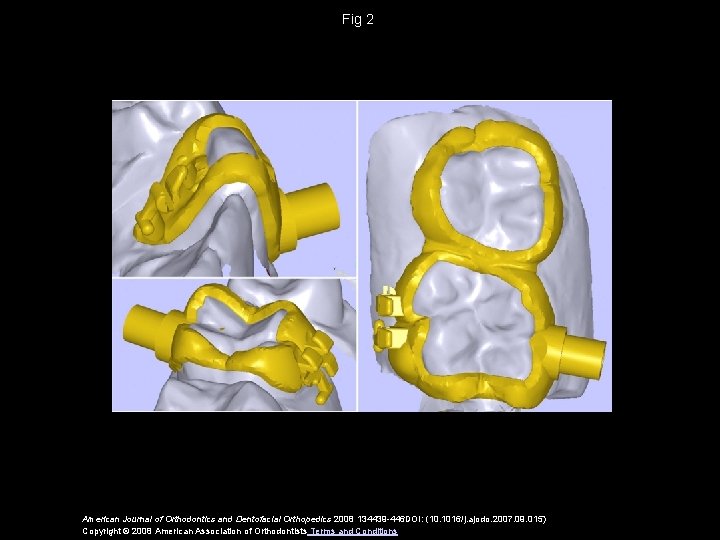 Fig 2 American Journal of Orthodontics and Dentofacial Orthopedics 2008 134439 -446 DOI: (10.