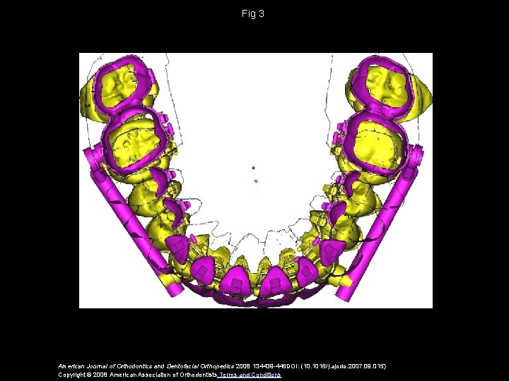 Fig 3 American Journal of Orthodontics and Dentofacial Orthopedics 2008 134439 -446 DOI: (10.
