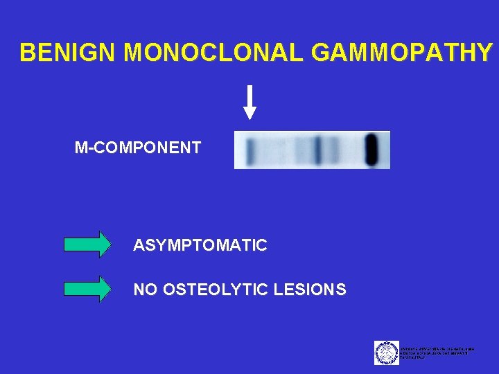 BENIGN MONOCLONAL GAMMOPATHY M-COMPONENT ASYMPTOMATIC NO OSTEOLYTIC LESIONS DIVISIONE UNIVERSITARIA DI EMATOLOGIA AZIENDA OSPEDALIERA
