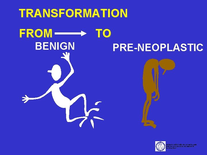 TRANSFORMATION FROM BENIGN TO PRE-NEOPLASTIC DIVISIONE UNIVERSITARIA DI EMATOLOGIA AZIENDA OSPEDALIERA SAN GIOVANNI TORINO,