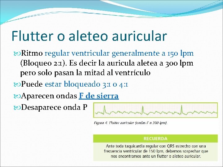 Flutter o aleteo auricular Ritmo regular ventricular generalmente a 150 lpm (Bloqueo 2: 1).
