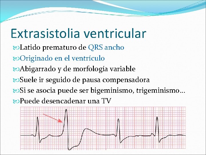 Extrasistolia ventricular Latido prematuro de QRS ancho Originado en el ventrículo Abigarrado y de